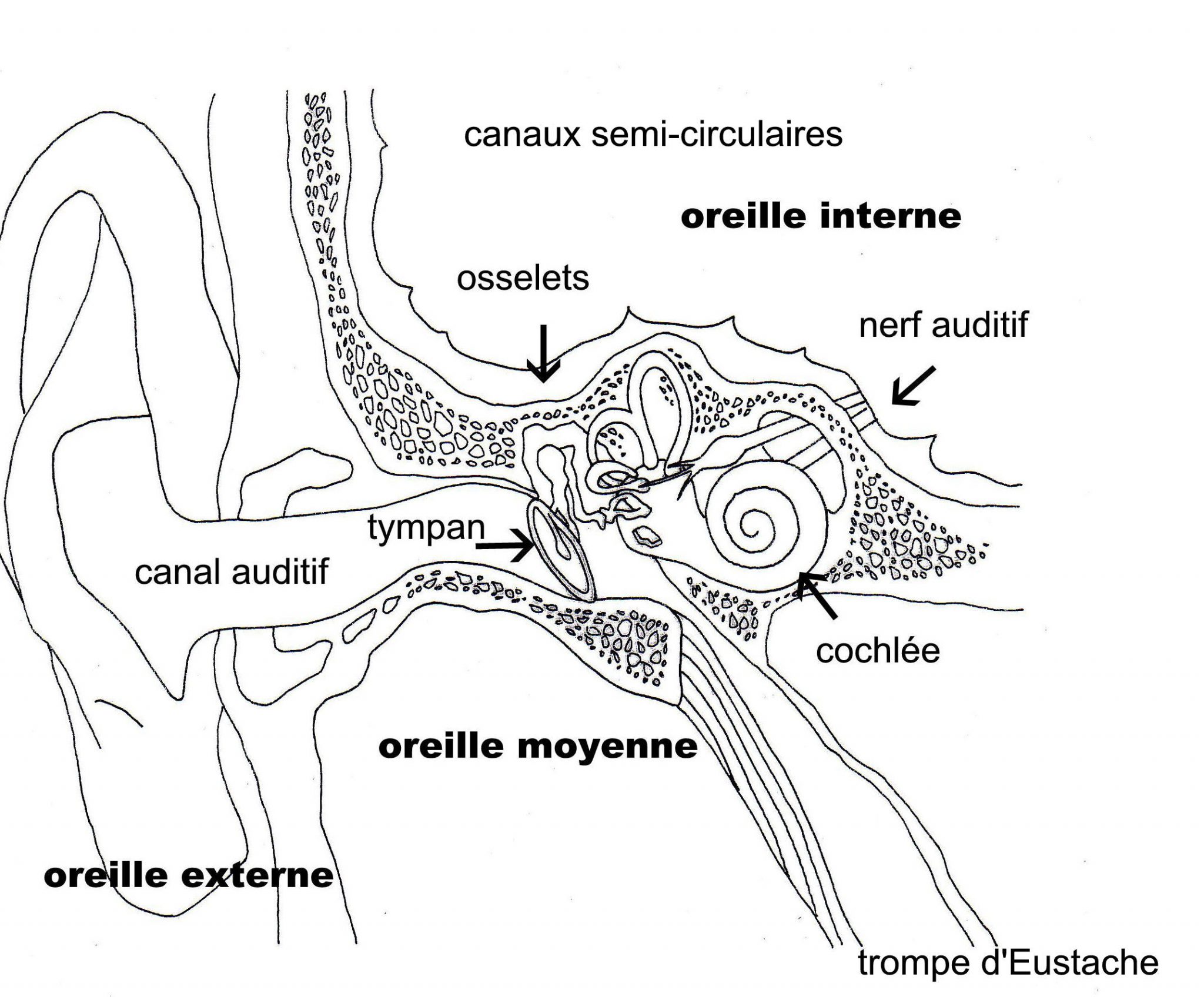L'implant cochléaire - INJS